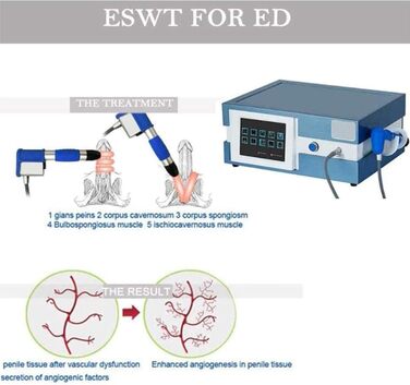 Пристрій для ударно-хвильової терапії ED Пристрій для ударно-хвильової терапії Фізіотерапевтичний апарат Пневматичний екстракорпоральний пристрій для ударно-хвильової терапії Пристрій для терапії Полегшення болю Масаж Еректильна дисфункція