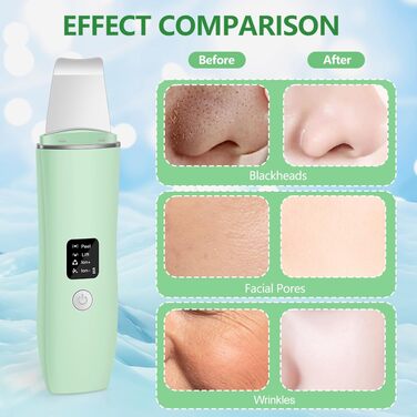 Скраб для шкіри ACWOO, пристрій для ультразвукового пілінгу для обличчя, ультразвуковий пристрій для обличчя для сяючої шкіри, лопатка для обличчя для видалення чорних крапок, засіб для очищення пір зелений