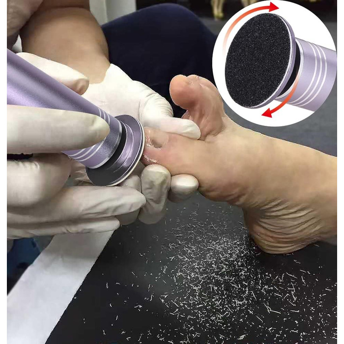 Електрична пилка для видалення мозолів з регульованою швидкістю для професійного педикюру зі змінними пилками для мертвої жорсткої потрісканої шкіри, зі змінною шліфувальною подушечкою 60 шт. (сіра)