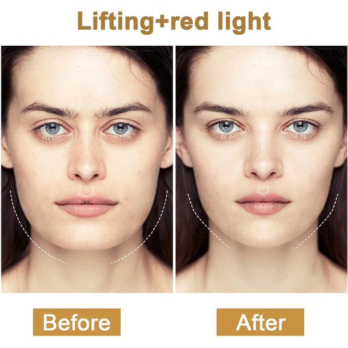 Радіочастотний пристрій Cozion для обличчя EMS пристрій для підтяжки обличчя 5 в 1 RF радіочастотний пристрій для обличчя зі світлодіодною світлотерапією Використовується для підтяжки шкіри та зменшення зморшок