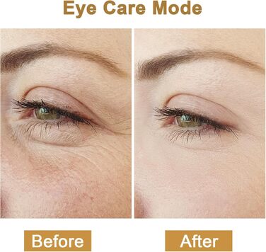 Радіочастотний пристрій Cozion для обличчя EMS пристрій для підтяжки обличчя 5 в 1 RF радіочастотний пристрій для обличчя зі світлодіодною світлотерапією Використовується для підтяжки шкіри та зменшення зморшок