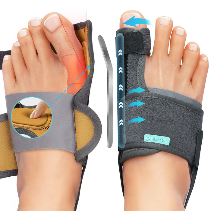 Покращує корекцію Hallux Valgus за допомогою 2 кутових прасок, потовщених силіконових накладок, розширювача пальців ніг, 1 пара шкарпеток-бандажів для Hallux Valgus