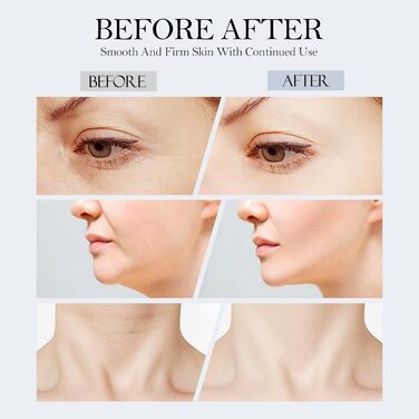 Масажер для обличчя Yofuly проти зморшок, пристрій для краси обличчя з 3 режимами, 45C проти зморшок для обличчя, підтяжка та ліфтинг шкіри, EMS масаж обличчя для жінок та чоловіків (нуар) Чорний