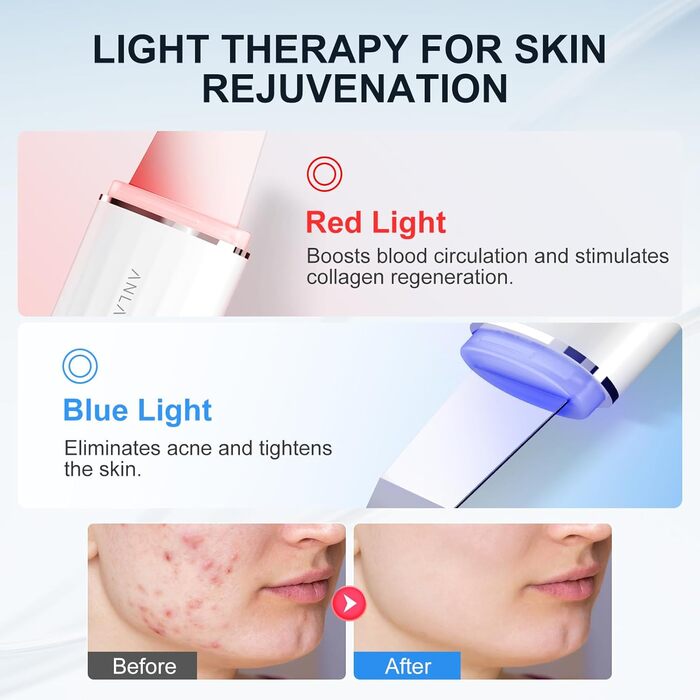 Пристрій для ультразвукового пілінгу для обличчя, ANLAN IPX7 Водонепроникний ультразвуковий скраб для шкіри 6 в 1 пристрій для очищення обличчя Синя червона лампа для очищення пор обличчя з зарядною базою Type-C
