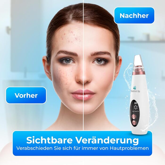 Засіб для очищення пор обличчя, засіб для видалення пор, засіб для очищення обличчя, засіб для видалення чорних крапок, пристрій для очищення обличчя, масажер для обличчя, очищення обличчя, догляд за шкірою, із захисною маскою